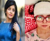 অভিনেত্রী এলিনা শাম্মী সড়ক দুর্ঘটনায় গুরুতর আহত, ১৫টি সেলাই লেগেছে কপালে